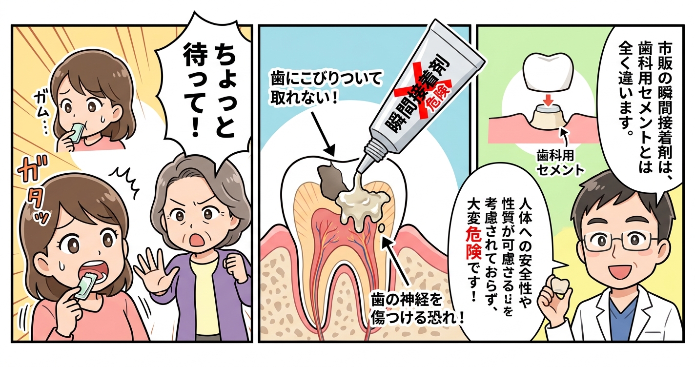 被せ物が取れた夜の正しい応急処置｜ガムや接着剤がNGな理由