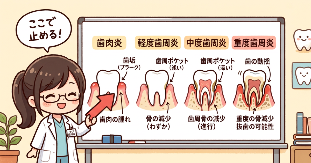 放置すると何が起こる？歯周病が進行するメカニズムと将来リスク