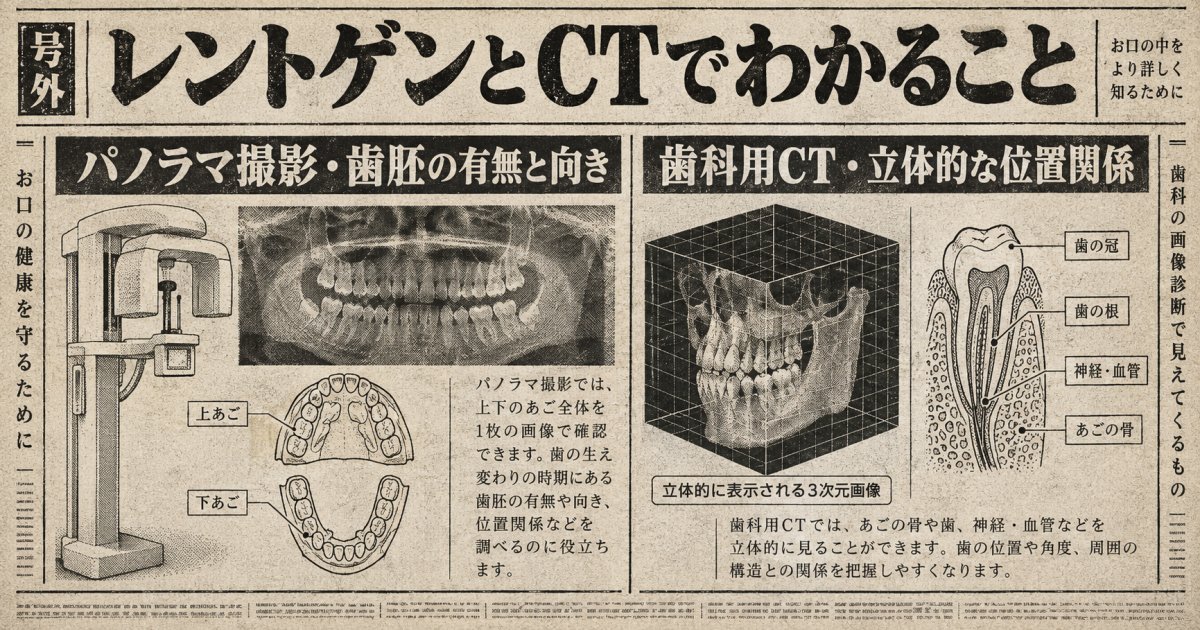 歯科医院で行う検査とレントゲン・CTでわかること